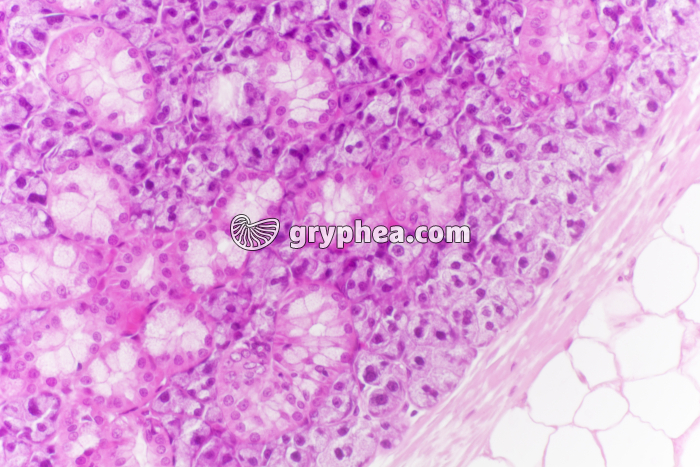 Parathyroïde x100 - gryphea.com